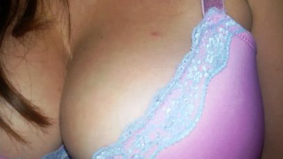 Zit on my Boobs