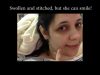 Heather Feather Surgery Update From Her Mom: Good News!