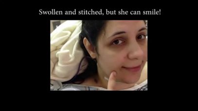 Heather Feather Surgery Update From Her Mom: Good News!