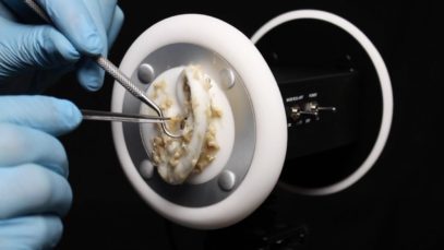 ASMR 3Dio Ear Peeling, Brushing Cleaning Latex Gloves – What Has Happened to Your Ears? (No talking)