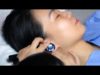 경력 20년 달인의 귀청소 | 실제 고막 긁는 소리 ASMR