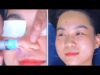 ASMR Pore Cleaning | Cosmetic Acupuncture | Blackhead Removal | ทำความสะอาดรูขุมขน